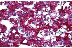 Human Adrenal: Formalin-Fixed, Paraffin-Embedded (FFPE) (PIM1 Antikörper  (AA 1-100))
