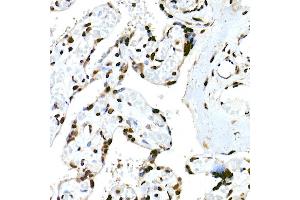 Immunohistochemistry of paraffin-embedded human placenta using RBM3 Rabbit mAb (ABIN7270084) at dilution of 1:25 (40x lens). (RBM3 Antikörper)