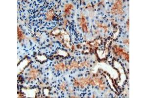 IHC-P analysis of kidney tissue, with DAB staining. (PDGF-BB Homodimer (AA 82-190) Antikörper)