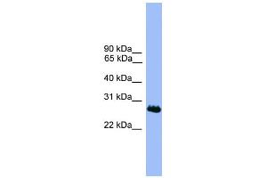 WB Suggested Anti-C1orf216 Antibody Titration: 0.