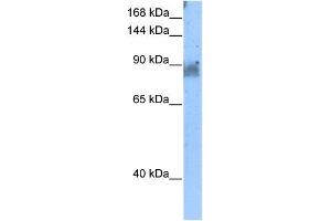NELL2 antibody used at 5 ug/ml to detect target protein. (NELL2 Antikörper)