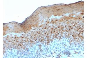 Formalin-fixed, paraffin-embedded human Tonsil stained with Involucrin Mouse Monoclonal Antibody (SY5). (Involucrin Antikörper)