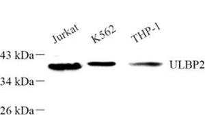 Western blot analysis of ULBP256 (ABIN7076145) at dilution of 1: 500