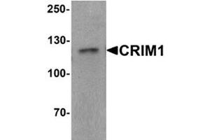 Western blot analysis of CRIM1 in Jurkat cell lysate with CRIM1 Antibody  at 1 ug/ml. (CRIM1 Antikörper  (C-Term))