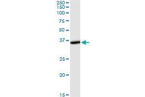 THUMPD1 monoclonal antibody (M01), clone 4A11. (THUMPD1 Antikörper  (AA 1-353))