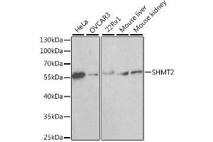Western blot analysis of extracts of various cell lines, using SHMT2 antibody. (SHMT2 Antikörper  (AA 265-504))