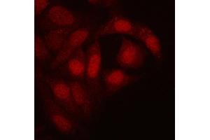 IF analysis of RTCB using anti-RTCB antibody (ABIN7600722).