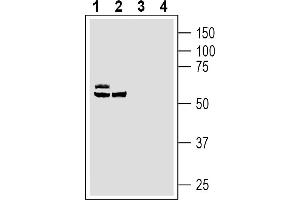 Western blot analysis of human LNCaP prostate carcinoma cell line lysates (lanes 1 and 3) and human  monocytic leukemia cell line lysates (lanes 2 and 4):1-2.