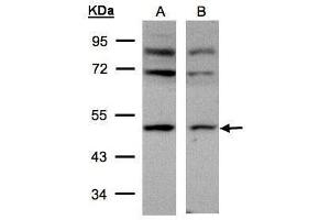 WB Image Sample(30 μg of whole cell lysate) A:293T B:HeLa S3, 10% SDS PAGE antibody diluted at 1:500 (AP2M1 Antikörper  (Center))