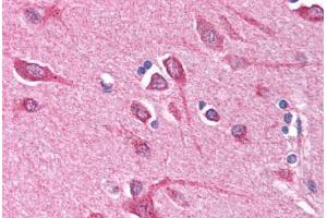 Human Brain, Cortex (formalin-fixed, paraffin-embedded) stained with BCL10 antibody ABIN214584 at 5 ug/ml followed by biotinylated goat anti-rabbit IgG secondary antibody ABIN481713, alkaline phosphatase-streptavidin and chromogen. (BCL10 Antikörper  (N-Term))