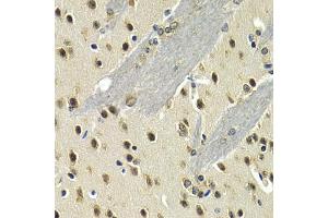Immunohistochemistry of paraffin-embedded mouse brain using MAX antibody (ABIN5971184) at dilution of 1/200 (40x lens). (MAX Antikörper)