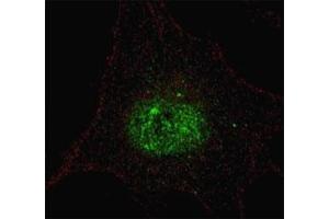 Fluorescent confocal image of SY5Y cells stained with phospho-PDX1 antibody. (PDX1 Antikörper  (pThr11))