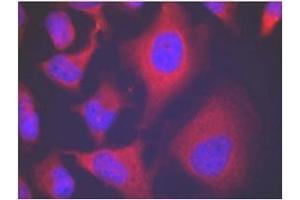 Image no. 3 for anti-Adducin 1 (Alpha) (ADD1) (pSer726) antibody (ABIN196918) (alpha Adducin Antikörper  (pSer726))