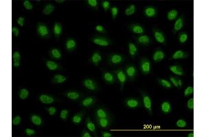Immunofluorescence of monoclonal antibody to BCL9 on HeLa cell. (BCL9 Antikörper  (AA 1036-1135))