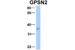 Host:  Rabbit  Target Name:  GPSN2  Sample Type:  Human Fetal Brain  Antibody Dilution:  1.