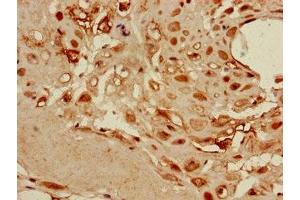 Immunohistochemistry of paraffin-embedded human placenta tissue using ABIN7149878 at dilution of 1:100 (DKK1 Antikörper  (AA 33-266))