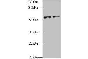 Western blot All lanes: NEK3 antibody at 6. (NEK3 Antikörper  (AA 267-506))