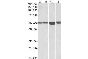 Western Blotting (WB) image for anti-Integrin-Linked Kinase (ILK) (C-Term) antibody (ABIN570904)