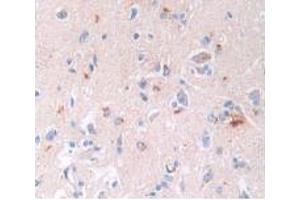 IHC-P analysis of Human Brain Tissue, with DAB staining. (BNP Antikörper)