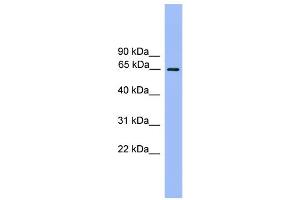 WB Suggested Anti-UBQLN2 Antibody Titration: 0. (Ubiquilin 2 Antikörper  (N-Term))