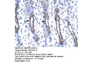 Immunohistochemistry (IHC) image for anti-Matrix Metallopeptidase 19 (MMP19) (N-Term) antibody (ABIN2779559)