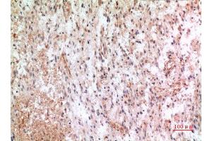 Immunohistochemistry (IHC) analysis of paraffin-embedded Human Brain, antibody was diluted at 1:100.