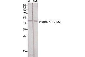 Western Blot (WB) analysis of specific cells using Phospho-ATF-2 (S62) Polyclonal Antibody. (ATF2 Antikörper  (pSer62))