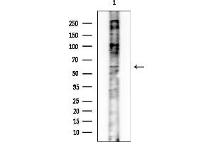 anti-IQ Motif Containing B1 (IQCB1) (Internal Region) antibody