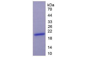 SDS-PAGE analysis of Human Keratin 9 Protein. (KRT9 Protein)