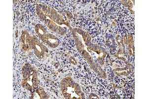 IHC analysis of RPL10 using anti-RPL10 antibody (ABIN7601177).