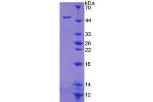 Image no. 1 for Integrin alpha-8 (ITGA8) (AA 907-1063) protein (His tag,GST tag) (ABIN6238252) (ITGA8 Protein (AA 907-1063) (His tag,GST tag))