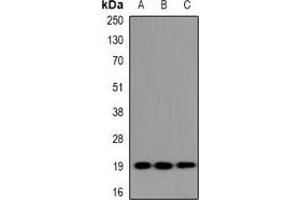 Western blot analysis of UBE2G1 expression in HeLa (A), NIH3T3 (B), H9C2 (C) whole cell lysates.