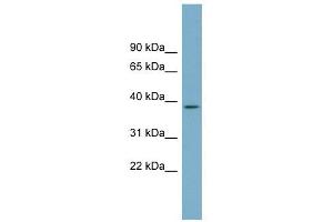 SDSL antibody used at 1 ug/ml to detect target protein. (SDSL Antikörper  (N-Term))