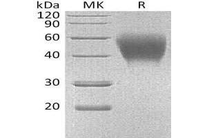 Western Blotting (WB) image for Signaling Lymphocytic Activation Molecule Family Member 1 (SLAMF1) protein (His tag) (ABIN7320651)