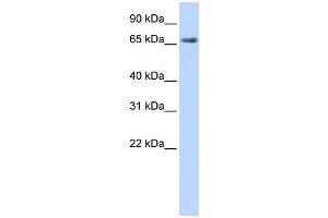 WB Suggested Anti-DLG3 Antibody Titration:  0.
