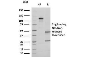 SDS-PAGE (SDS) image for anti-Ezrin (EZR) antibody (ABIN6940877)