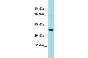 Western Blotting (WB) image for anti-G Kinase Anchoring Protein 1 (GKAP1) (N-Term) antibody (ABIN2791554)