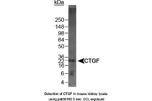 Image no. 1 for anti-Connective Tissue Growth Factor (CTGF) (C-Term) antibody (ABIN363491) (CTGF Antikörper  (C-Term))