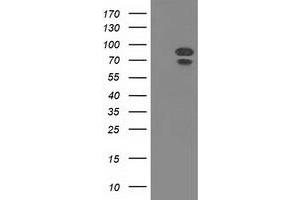 Western Blotting (WB) image for anti-Mitogen-Activated Protein Kinase 12 (MAPK12) antibody (ABIN1499307)
