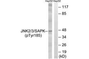 Western blot analysis of extracts from HepG2 cells treated with nocodazole 1ug/ml 16h, using SAPK/JNK (Phospho-Tyr185) Antibody. (SAPK, JNK (AA 151-200), (pTyr185) Antikörper)