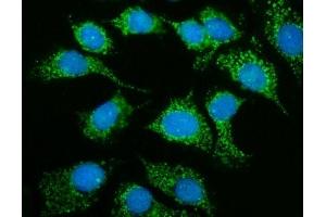 IF analysis of MRPS25 using anti-MRPS25 antibody (ABIN7599032).
