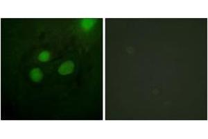 Immunofluorescence analysis of HeLa cells, using RFA2 (Ab-21) Antibody.