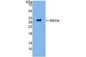 Detection of Recombinant ADCY1, Human using Polyclonal Antibody to Adenylate Cyclase 1, Brain (ADCY1)
