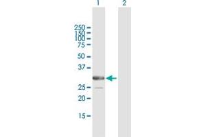 Western Blot analysis of ARMC10 expression in transfected 293T cell line by ARMC10 MaxPab polyclonal antibody. (ARMC10 Antikörper  (AA 1-308))