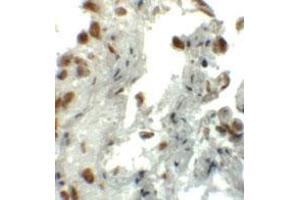 Immunohistochemical staining of human lung cells with EZH1 polyclonal antibody  at 5 ug/mL. (EZH1 Antikörper  (N-Term))