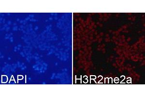 Immunofluorescence analysis of 293T cells using Asymmetric DiMethyl-Histone H3-R2 antibody. (Histone 3 Antikörper  (H3R2me2))