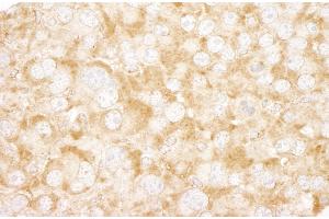 Immunohistochemistry (IHC) image for anti-UV Radiation Resistance Associated Gene (UVRAG) (AA 649-699) antibody (ABIN7448857) (UVRAG Antikörper  (AA 649-699))