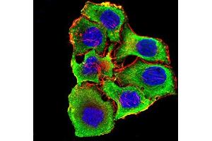 Immunofluorescence (IF) image for anti-Cholinergic Receptor, Nicotinic, alpha 3 (Neuronal) (CHRNA3) (AA 32-240) antibody (ABIN5611357)