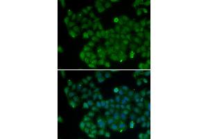 Immunofluorescence analysis of U20S cell using DNMT3L antibody. (DNMT3L Antikörper)