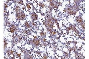 IHC analysis of MCM6 using anti-MCM6 antibody (ABIN7600035). (MCM6 Antikörper  (AA 14-821))